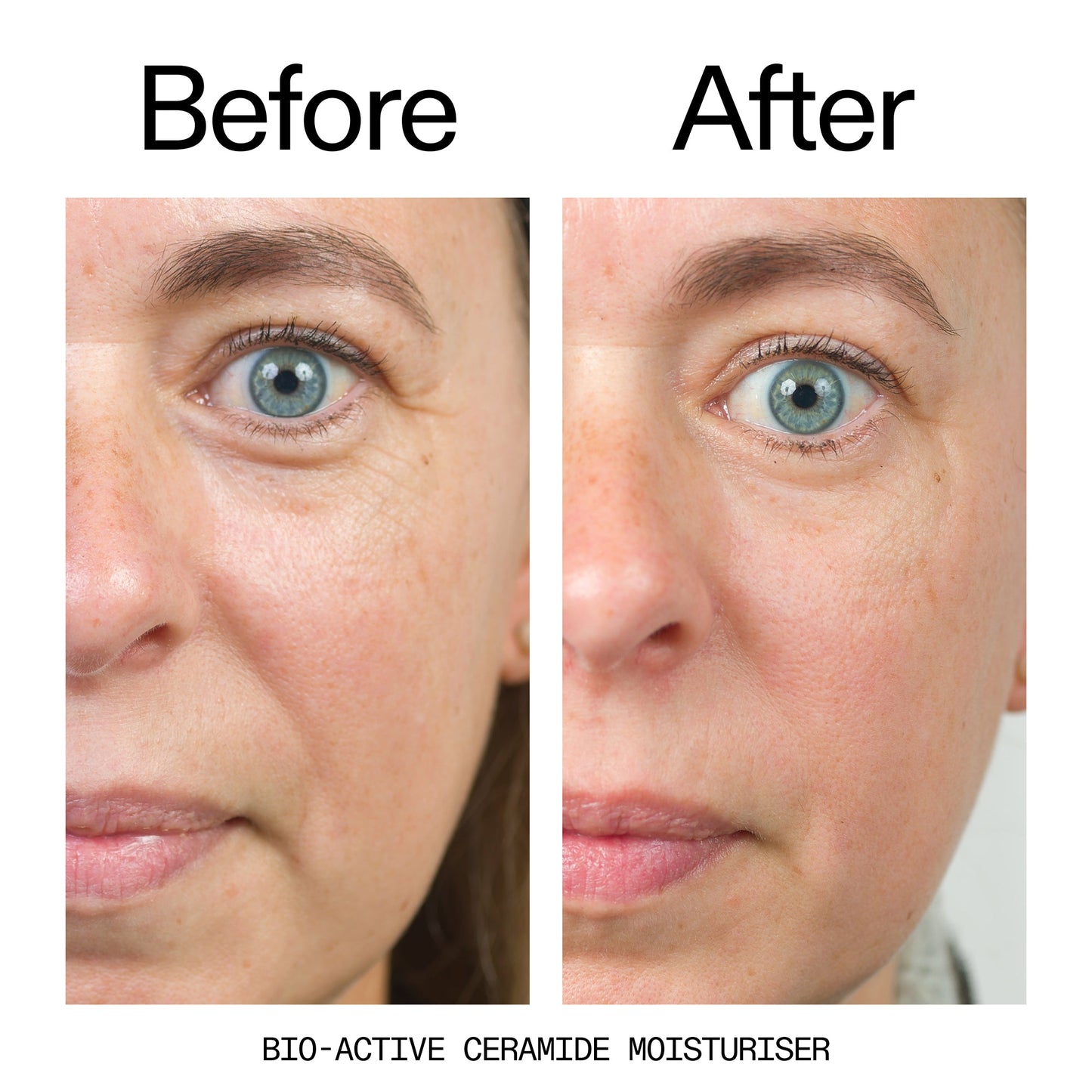 barrier-boosting-trio-n1 Bio-Active_Before_After_2000x2000_600947b4-e8c5-425a-9155-fc15bc83aa12.jpg
