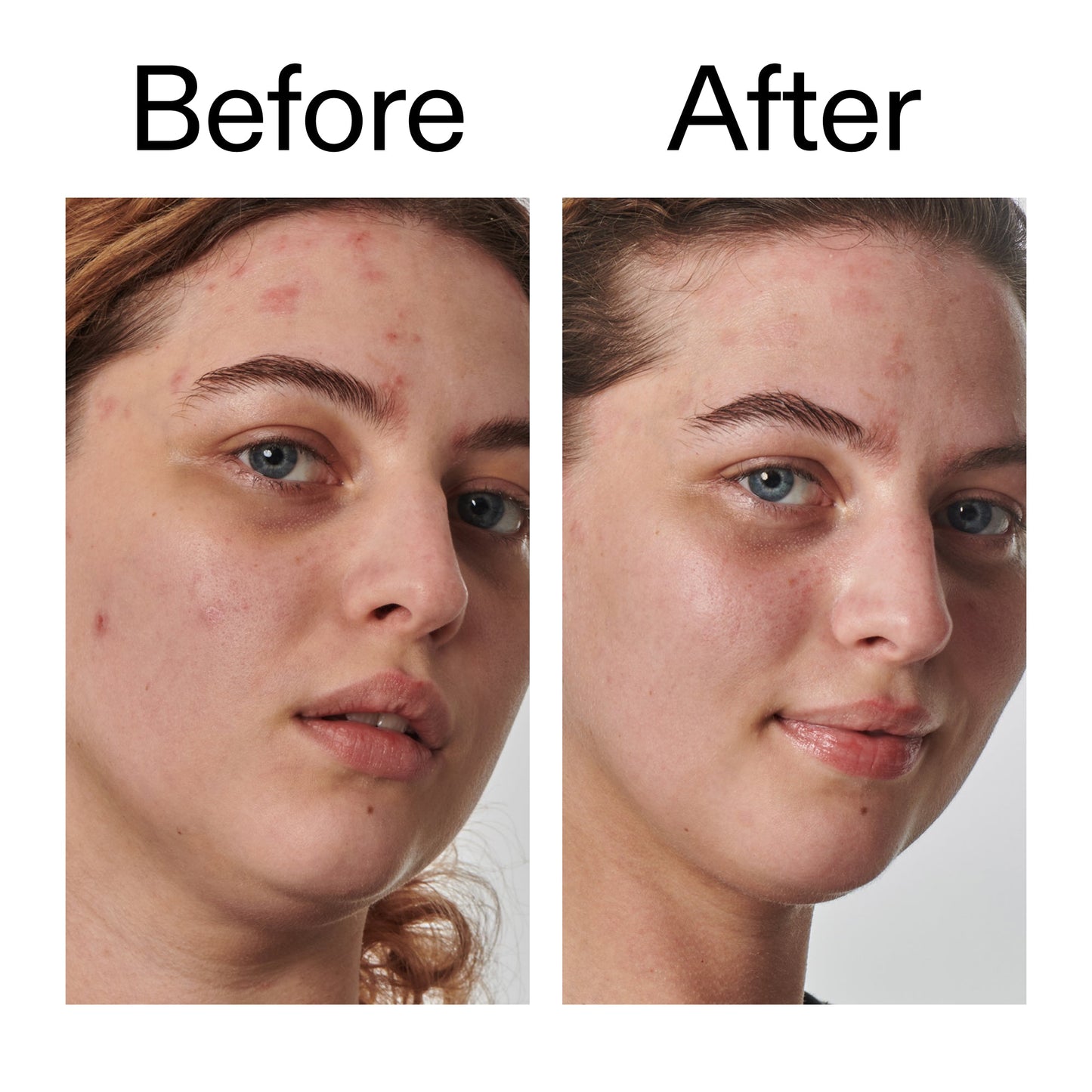 10-urea-moisturizer-b0 Dry_and_Rough_Skin_Solution_Before_After_2000x2000_efa6e639-5c39-49bd-a5dd-f0220293120a.jpg