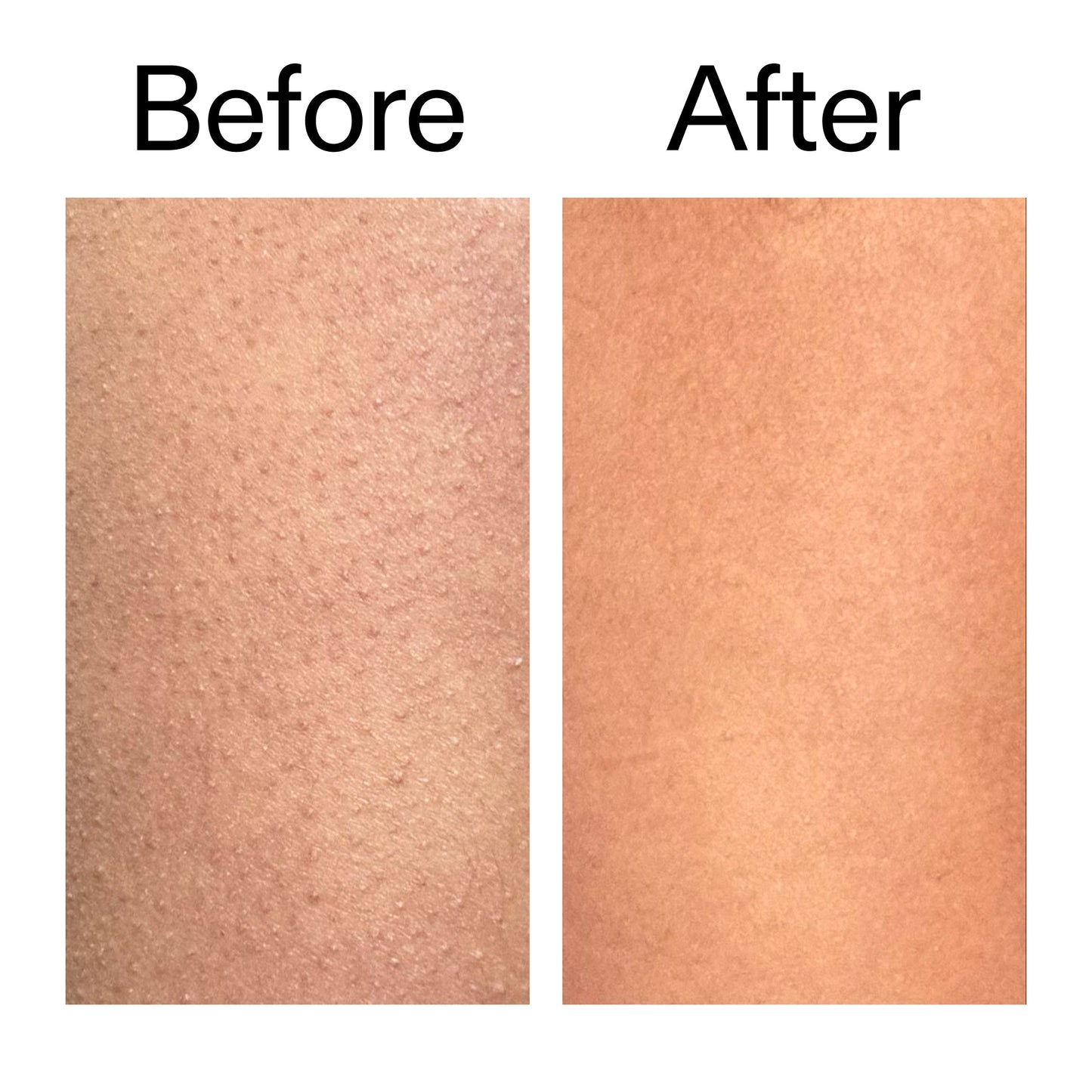glycolic-acid-exfoliating-body-stick-z0 Glycolic_Body_Stick_B_A_2000x2000_6e6e6b4d-5bd7-43c0-aeed-4d66788e8995.jpg