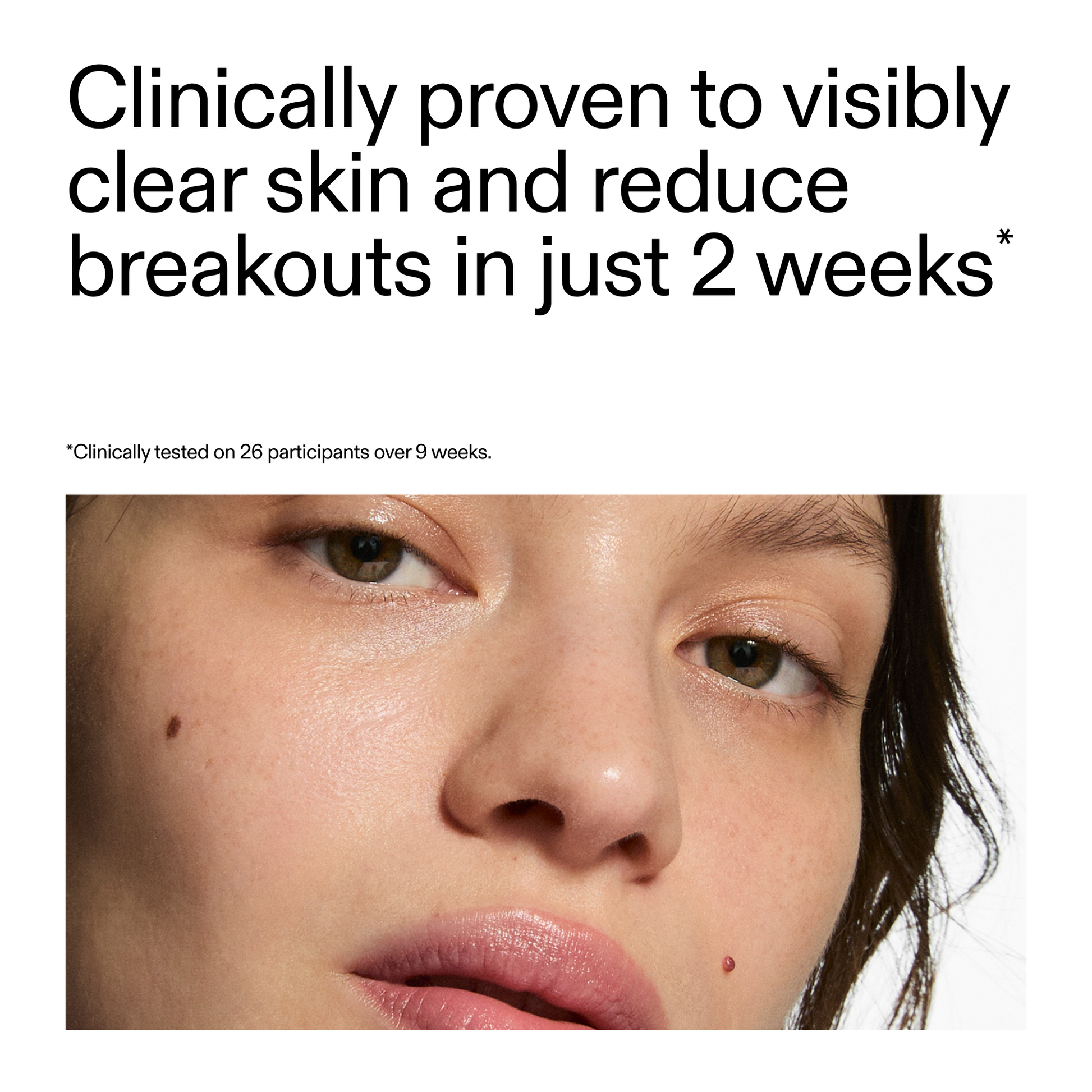 360-acne-clearing-serum-c0 360_Serum_Key_Claim.png