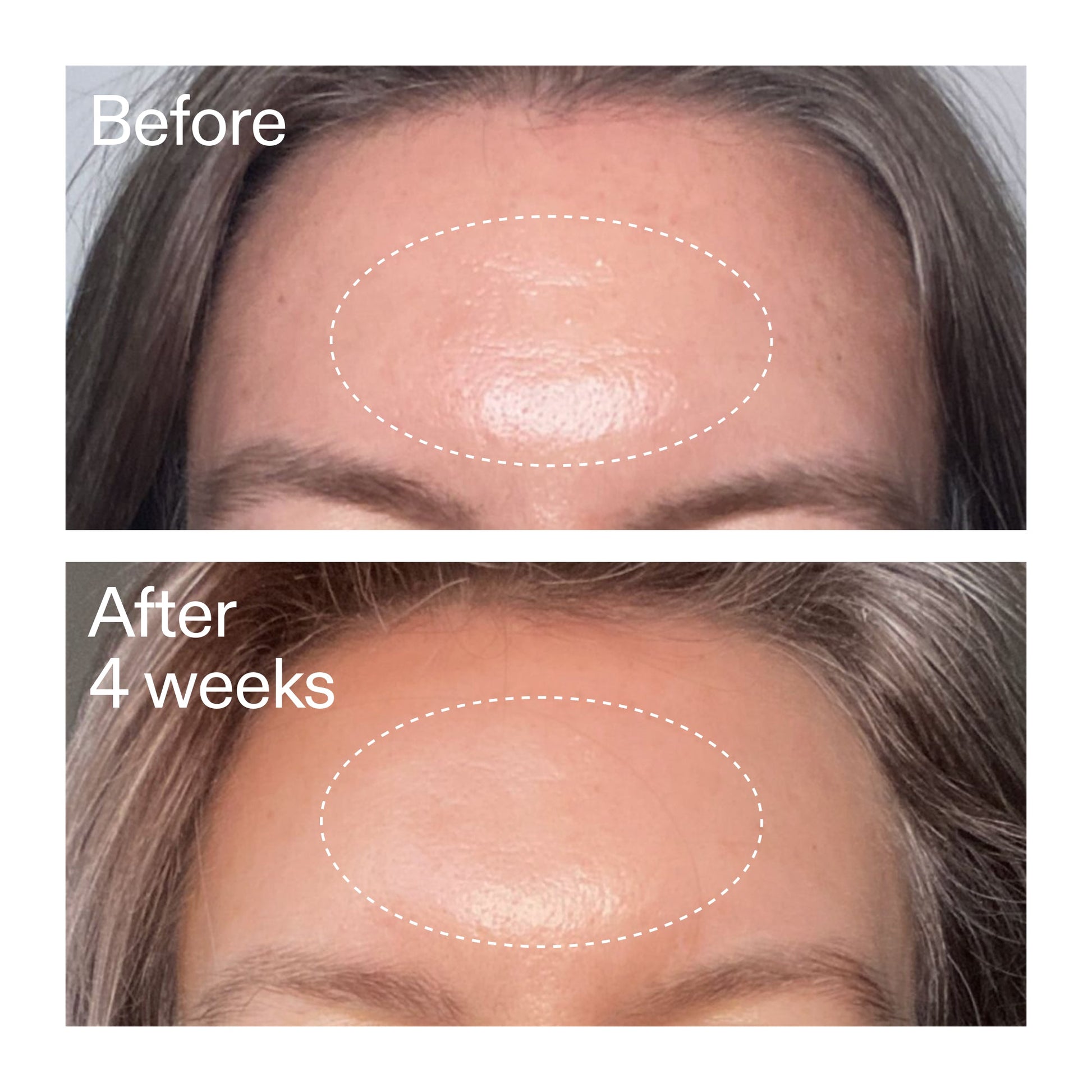 advanced-0-2-retinal-serum-duo-a9 AdvancedRetinal_BeforeAfter1_2000x2000_4e9c798a-f30e-45b8-a34a-7c4740f2f2cb.jpg