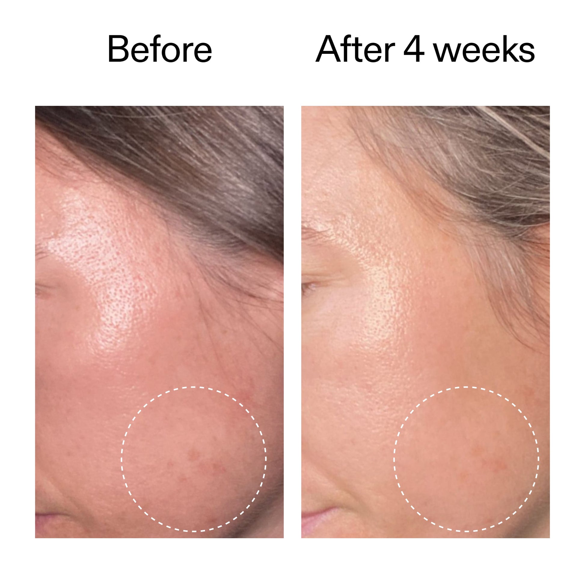 advanced-0-2-retinal-serum-duo-a9 AdvancedRetinal_BeforeAfter2__2000x2000_8ef75542-2316-4814-81ee-0f66a85912bc.jpg