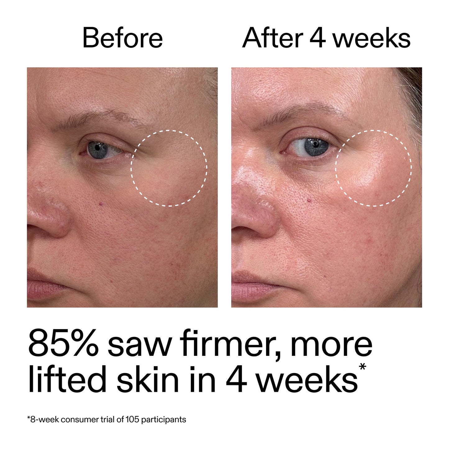 advanced-0-2-retinal-serum-q1 AdvancedRetinal_BeforeAfter_Claim1_2000x2000_bcc385c4-5e73-4f1e-aba8-64267937d0d3.jpg