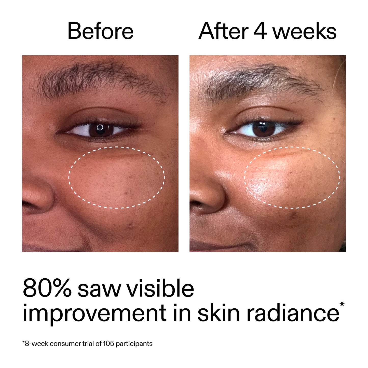 advanced-0-2-retinal-serum-q1 AdvancedRetinal_BeforeAfter_Claim2_2000x2000_39d11e3d-eda9-44ec-ab32-2903b1a368bd.jpg