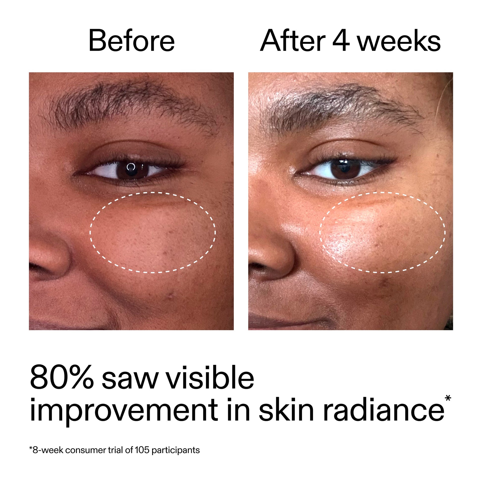 advanced-0-2-retinal-serum-q1 AdvancedRetinal_BeforeAfter_Claim2_2000x2000_39d11e3d-eda9-44ec-ab32-2903b1a368bd.jpg