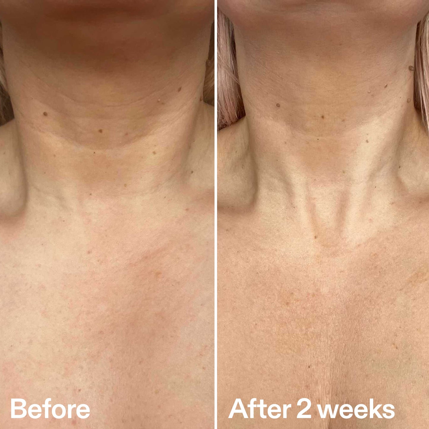 bio-active-neck-lift-stick-b1 B_A_2.jpg