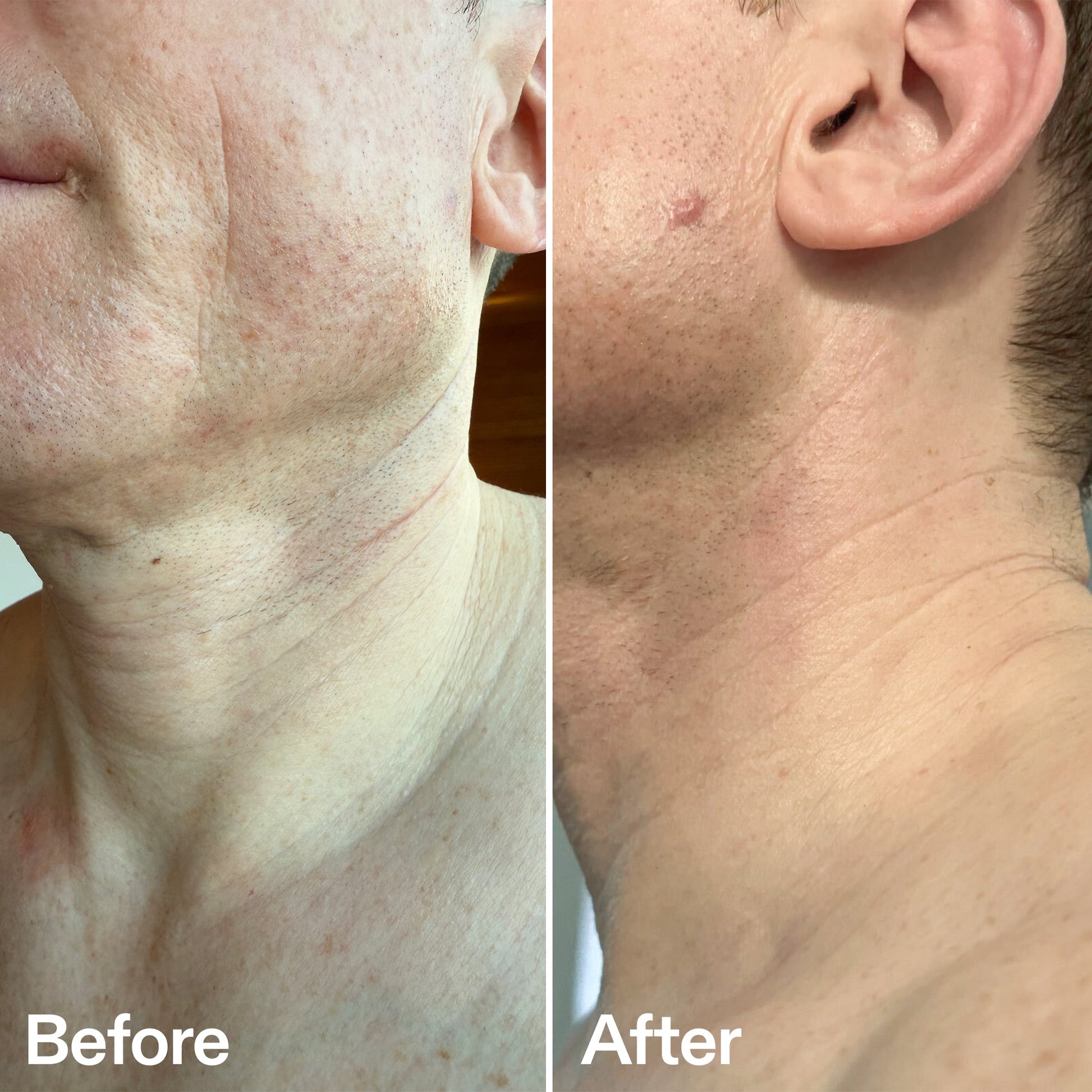 bio-active-neck-lift-stick-b1 B_A_afa2743e-b8e2-4504-92f4-e281cb6cf759.jpg