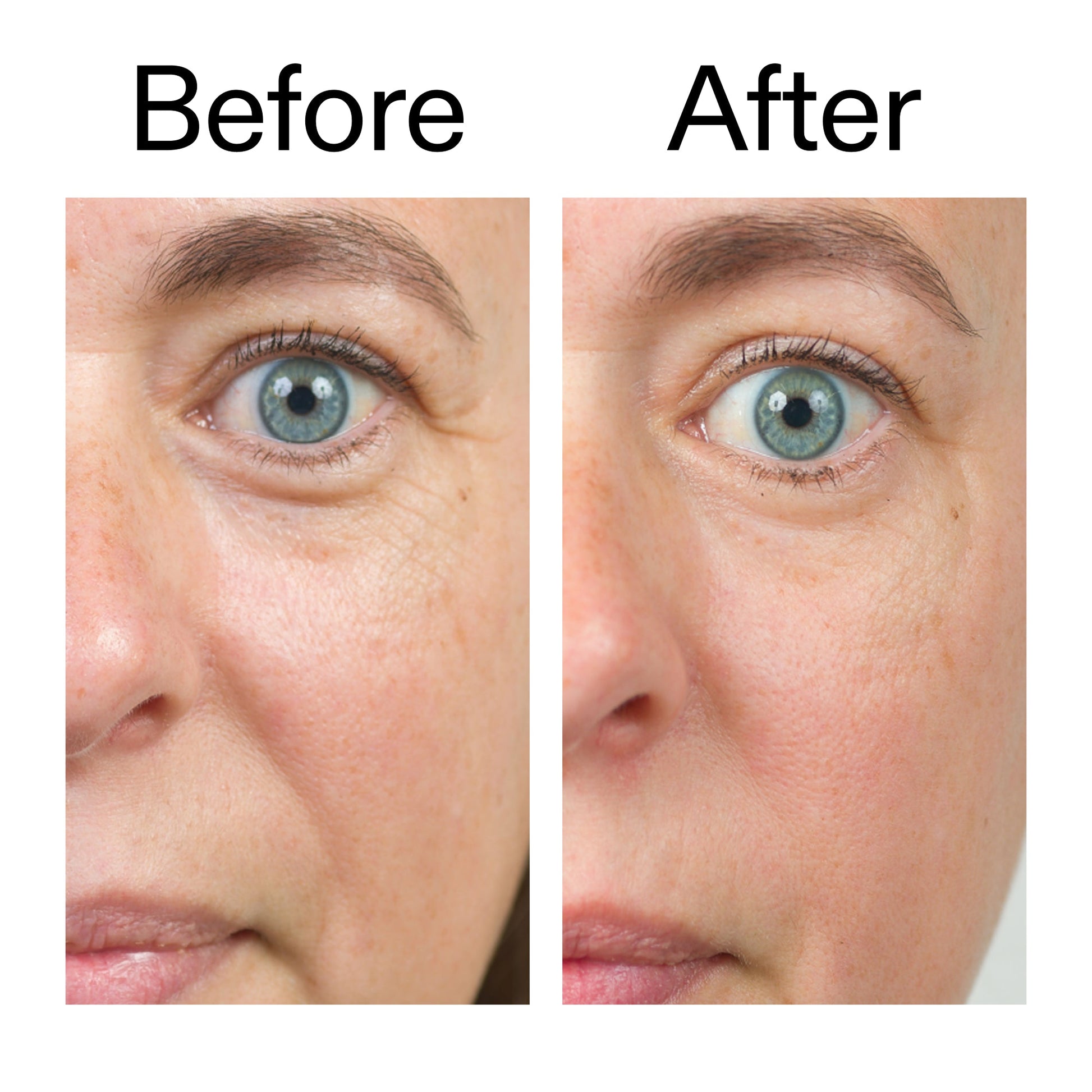 bio-active-ceramide-moisturizer-r7 Bio-Active_Before_After_2000x2000_566e5a9e-135e-417a-8242-b44e5fa35463.jpg