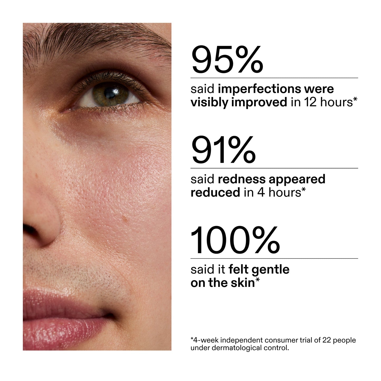 succinic-acid-acne-treatment-s3 CA_Succinic_Acid_Treatment_key_Claims_2000x2000_db91b0f1-7f29-4bfe-bb16-63a47f500960.jpg