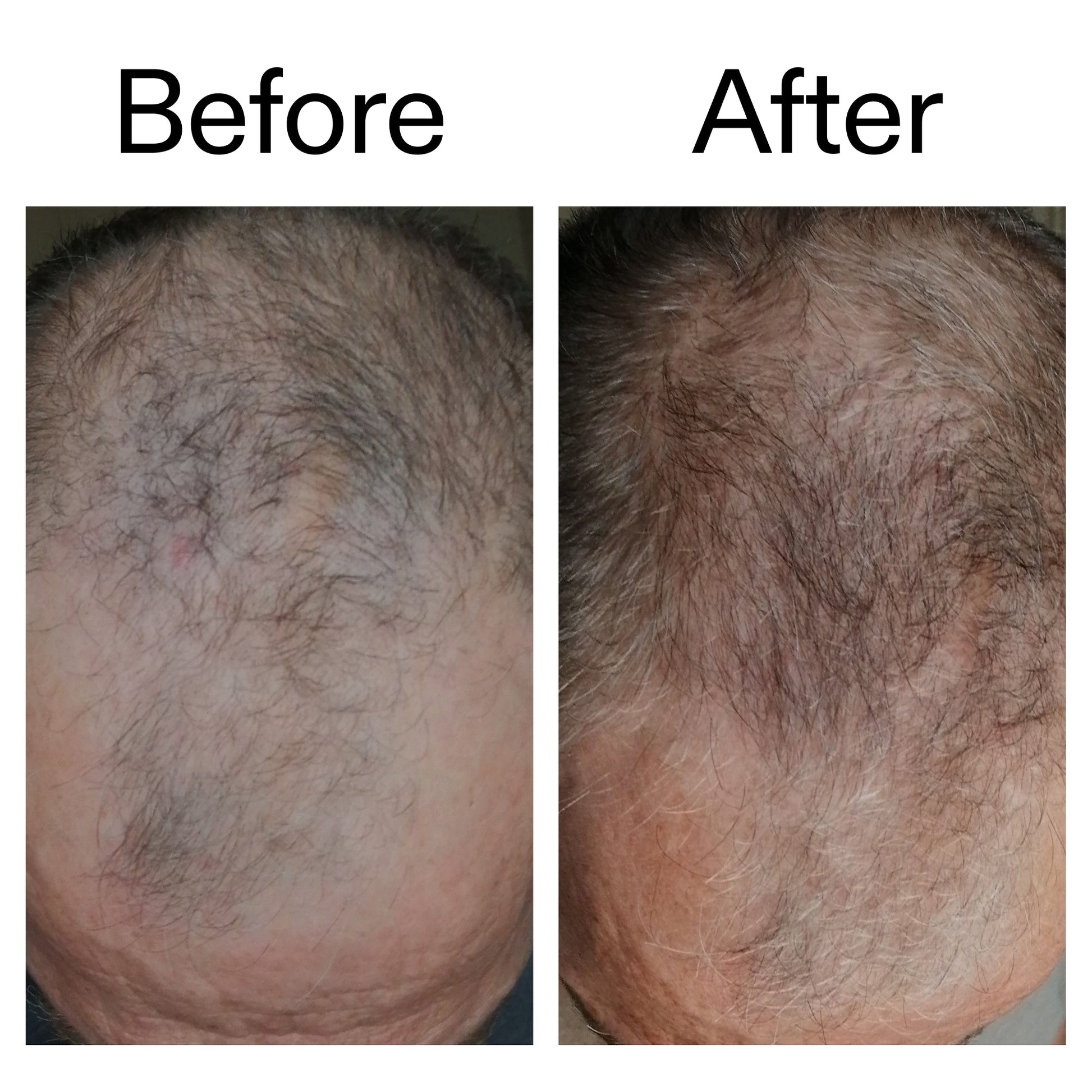 3-month-hair-growth-trio-n1 Caffeine_Scalp_Treatment_B_A_Ppage_2000_x_2000.jpg