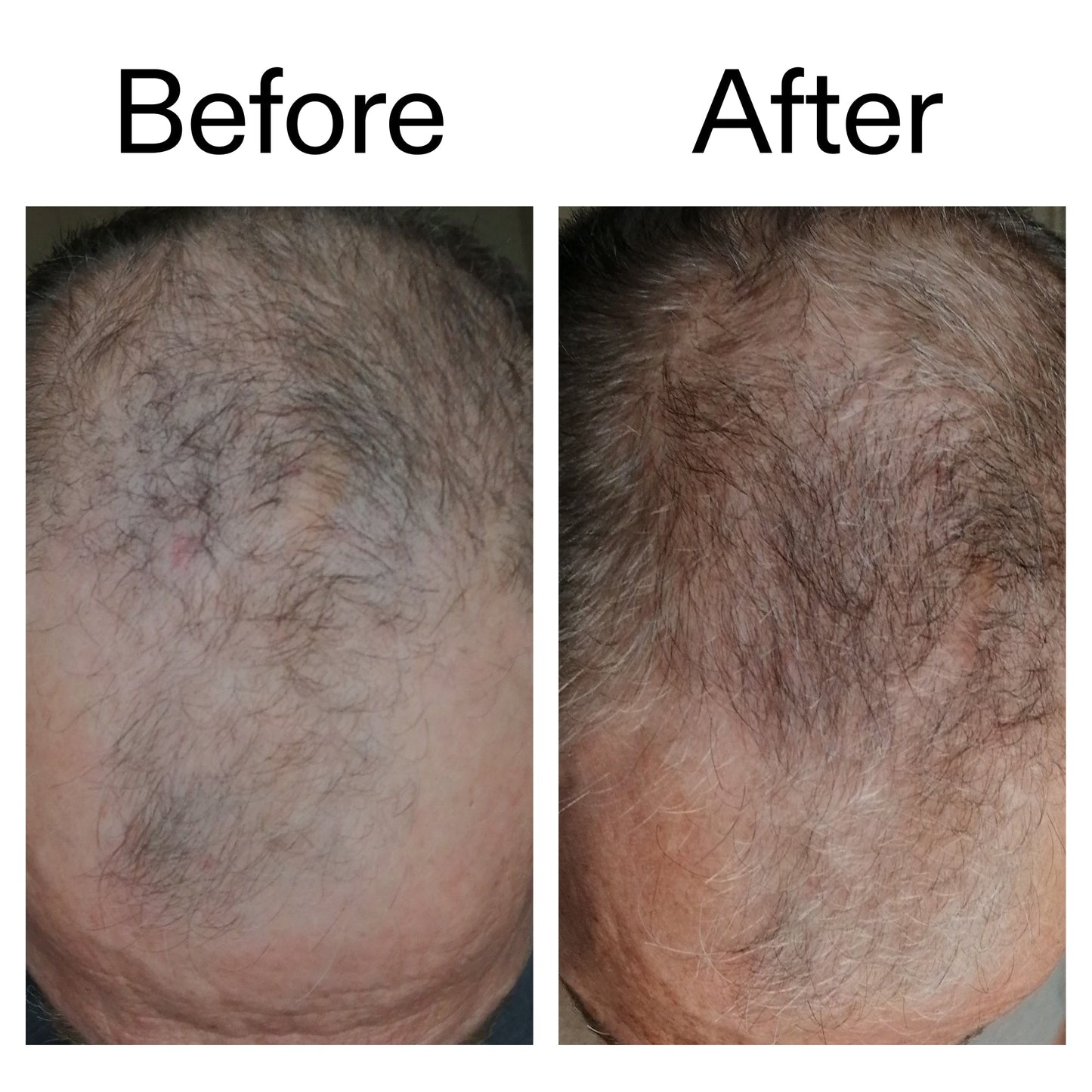 caffeine-stimulating-scalp-treatment-q3 Caffeine_Scalp_Treatment_B_A_Ppage_2000_x_2000.jpg