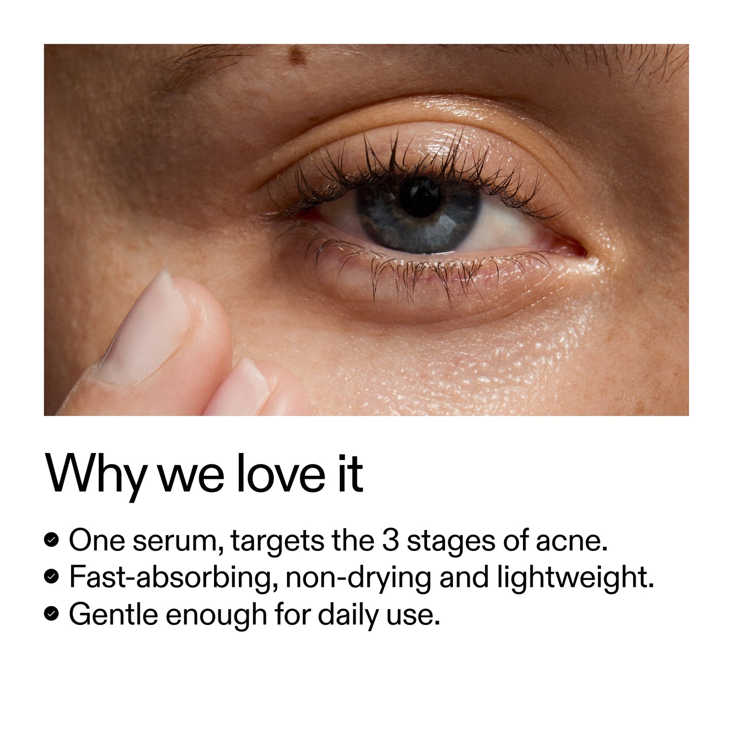 360-acne-clearing-serum-c0 Dioic_Whyweloveit_2000x2000_175aafd3-0cbe-403a-b317-a8362881bfe2.jpg