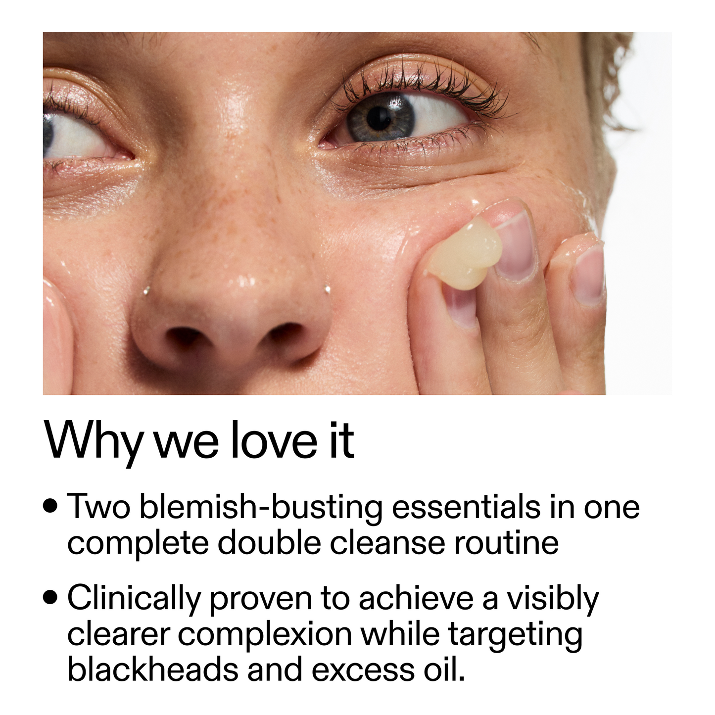 acne-double-cleanse-duo-w4 Double_Cleanse_Duo_for_Breakouts_Why_We_2000x2000_f242cb12-bb5c-487c-b203-071ccb406ec5.png