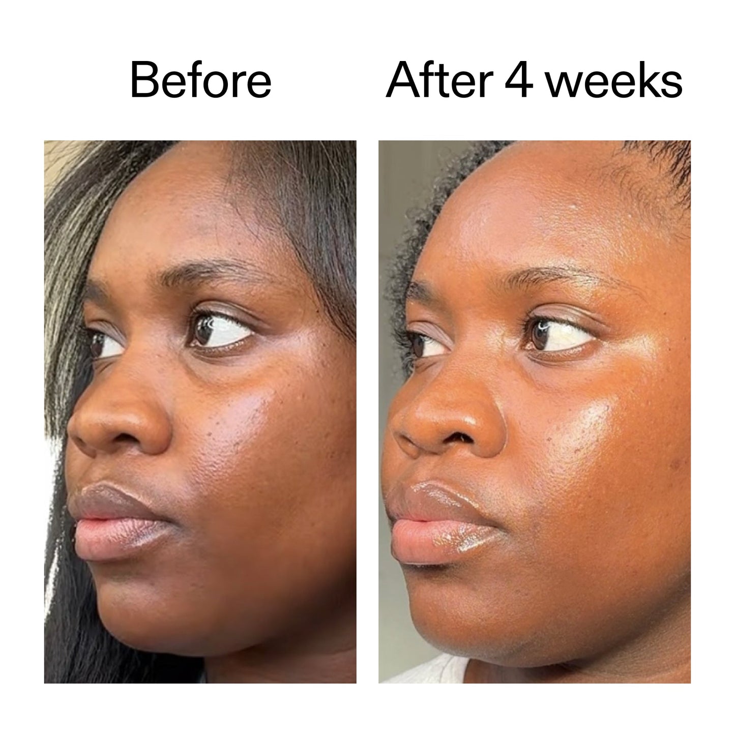 exosome-hydro-glow-complex-duo-q8 Exosome_Before_After_V12_2000x2000_2e7d50e1-0ed9-4624-91c6-1f94c0266a04.jpg