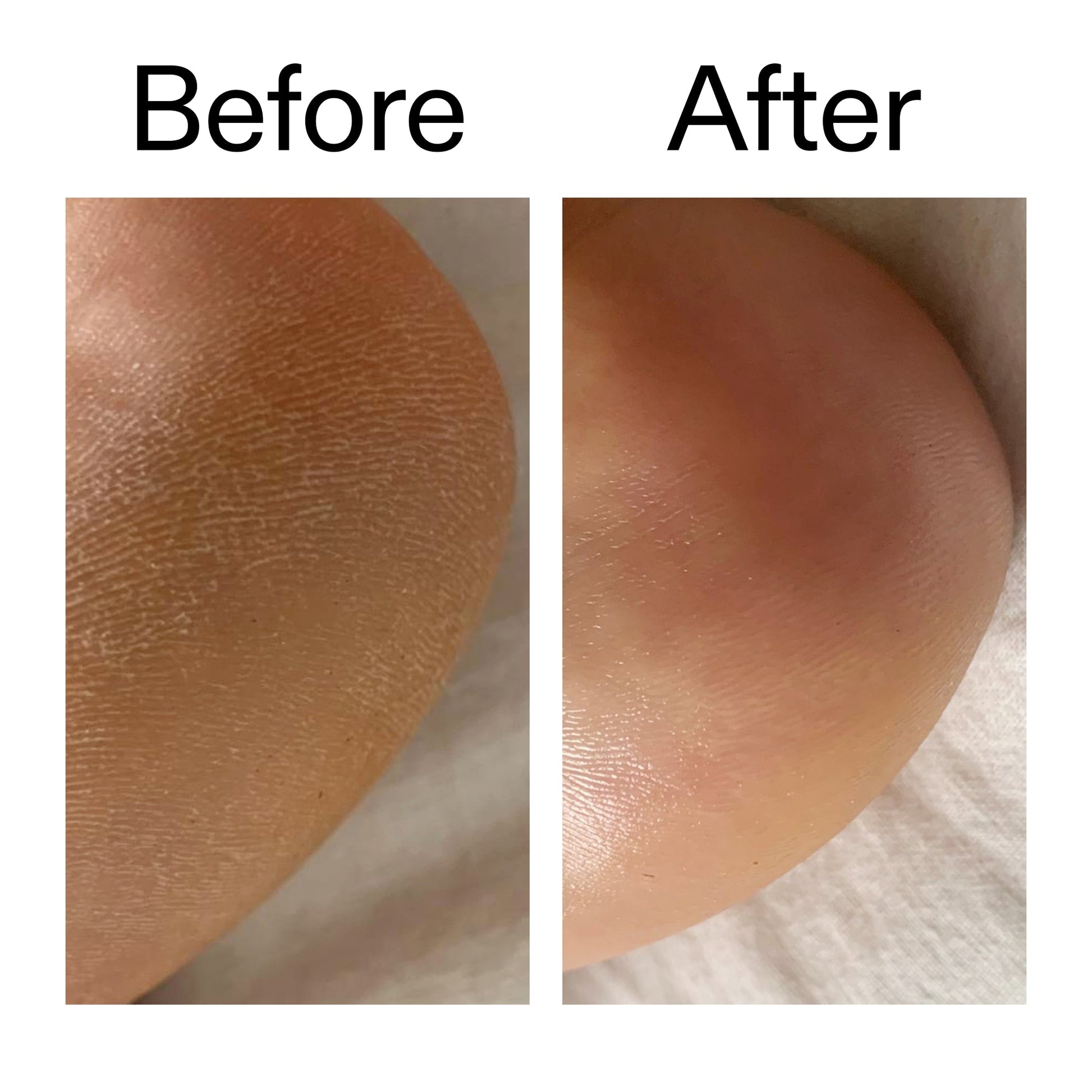 glycolic-acid-exfoliating-body-stick-z0 Glycolic_Acid_Exfoliating_Body_Stick_Before_After_V1_2000x2000_a3043625-9400-429a-a7fb-d6dbd220f722.jpg