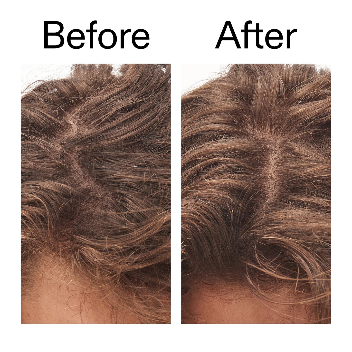 glycolic-acid-exfoliating-scalp-scrub-i4 Glycolic_Acid_Exfoliating_Scalp_Scrub_Before_After_2000x2000_b8561c87-05a1-4caa-80f7-1b6b33d750f7.jpg