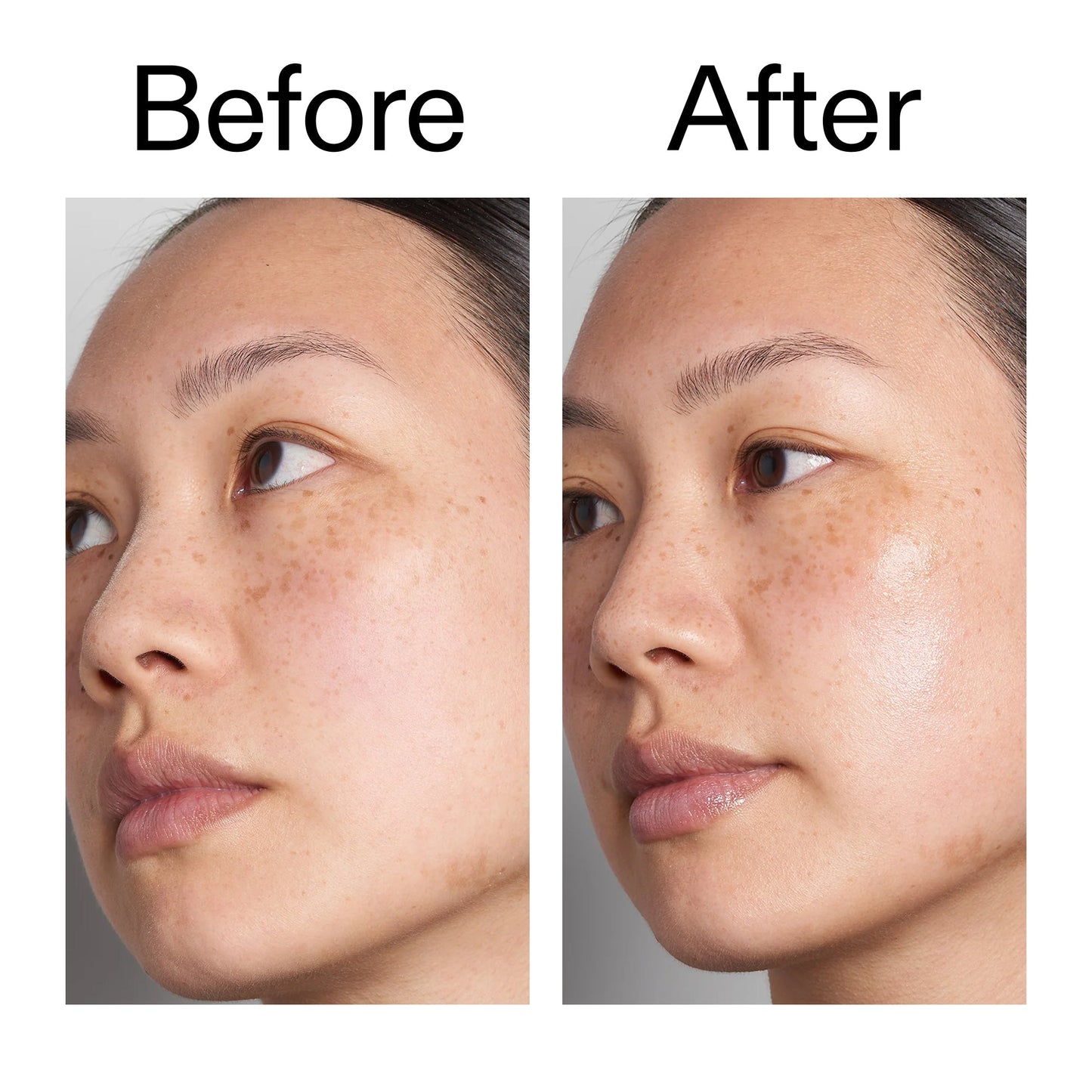 hyaluronic-acid-serum-60ml-duo-l6 Hyaluronic_Acid_Before_After_2000x2000_d566f5ba-a77e-4585-99fd-0f4682b164dd.jpg