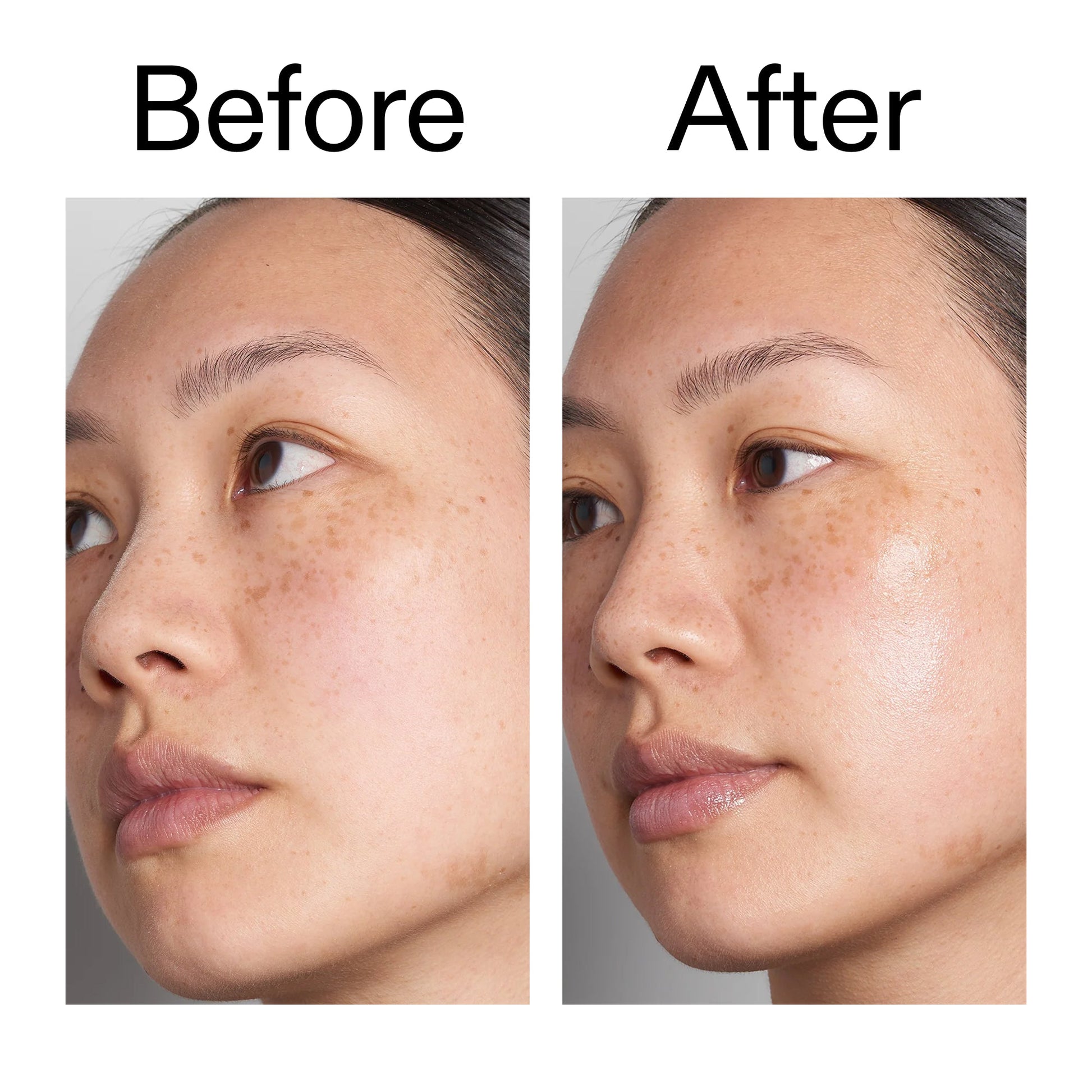 hyaluronic-acid-serum-60ml-duo-l6 Hyaluronic_Acid_Before_After_2000x2000_d566f5ba-a77e-4585-99fd-0f4682b164dd.jpg