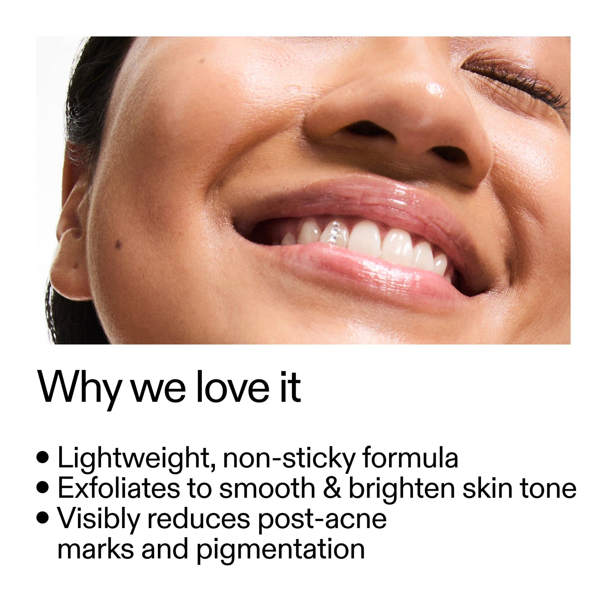 mandelic-acid-treatment-a7 Mandelic_Acid_Treatment_Why_we_love_it_2000x2000_6dfe29a9-2a79-464f-a5e8-e5ac37d93388.jpg