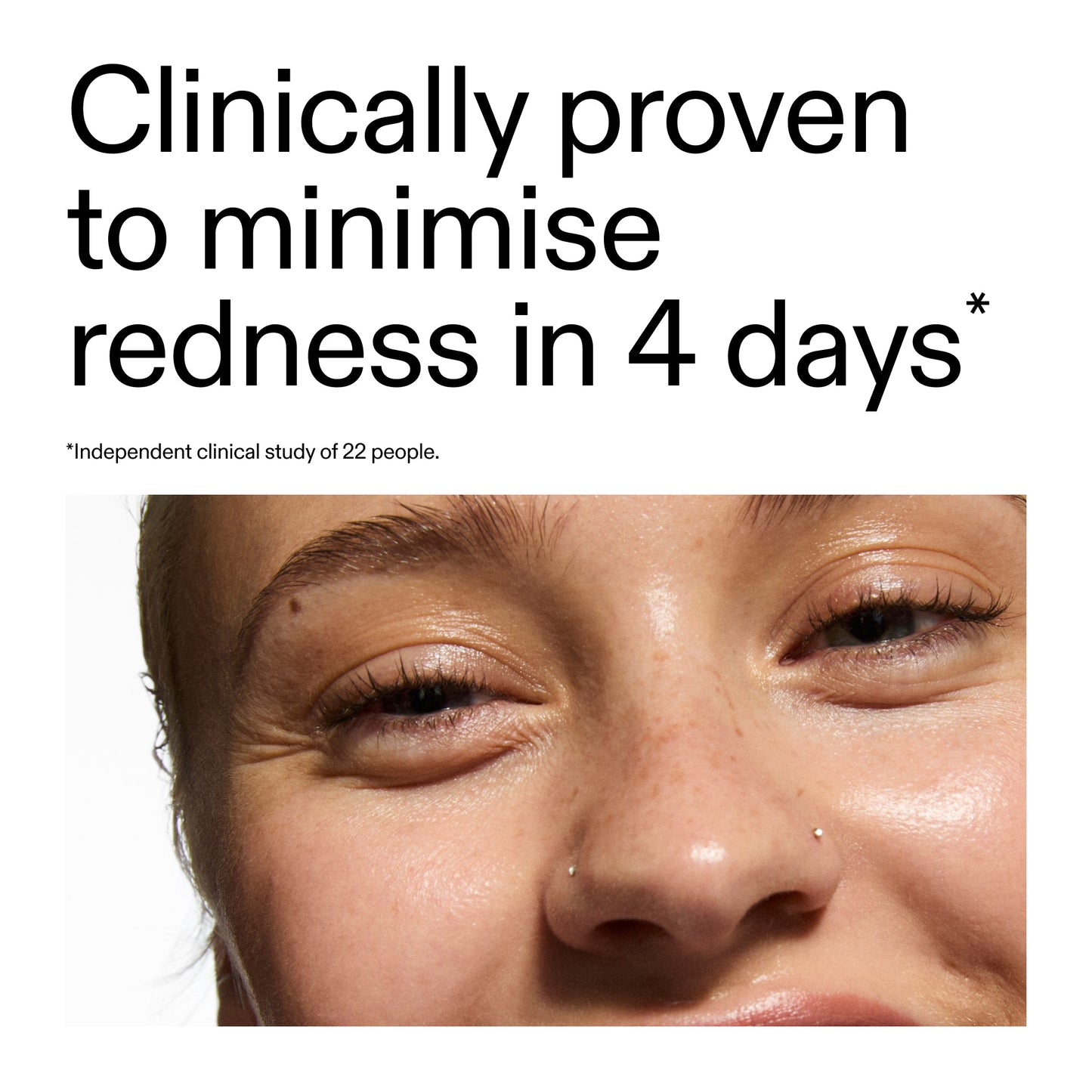 10-azelaic-acid-serum-for-redness-relief-l9 Oat_Cleansing_Balm_Claim_2000x2000_52a841dc-353c-4f2c-8646-3aadb604507d.jpg