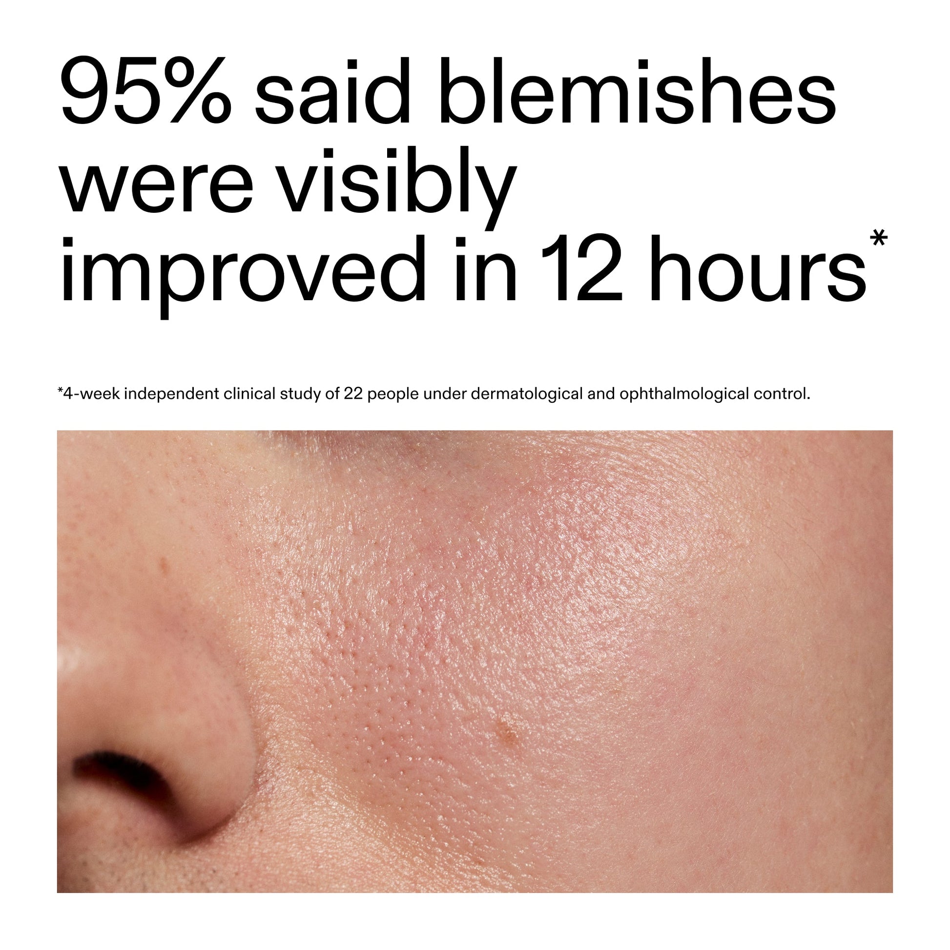 succinic-acid-acne-treatment-s3 Oat_Cleansing_Balm_Claim_2000x2000_ac6ce553-25db-41b2-a981-faae1ac4b8c0.jpg