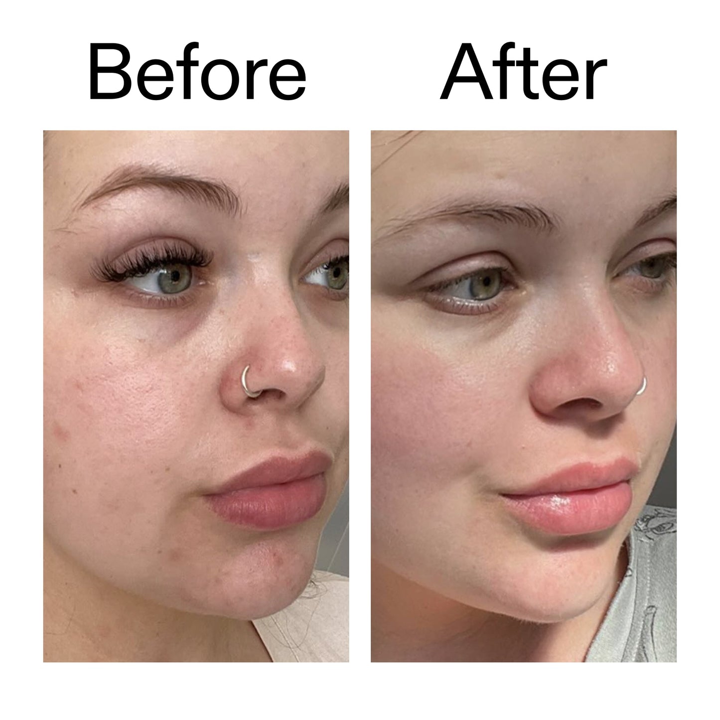 supersize-omega-water-cream-duo-n8 Omega50_Before_After_2000x2000_46483ed8-3f9d-487f-9a0c-9df79830bd65.jpg