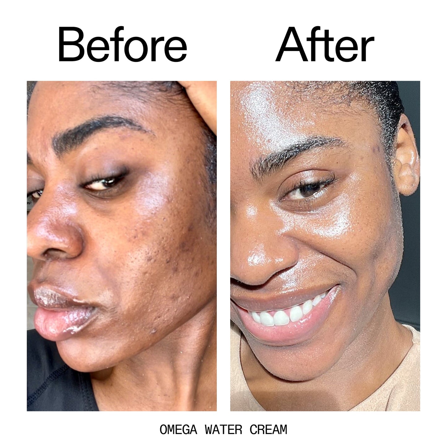 glowing-skin-set-w0 Omega_Water_Cream_Before_After_2000x2000_8e88278b-8c8d-48dc-ac77-4e98ebbd1b77.jpg
