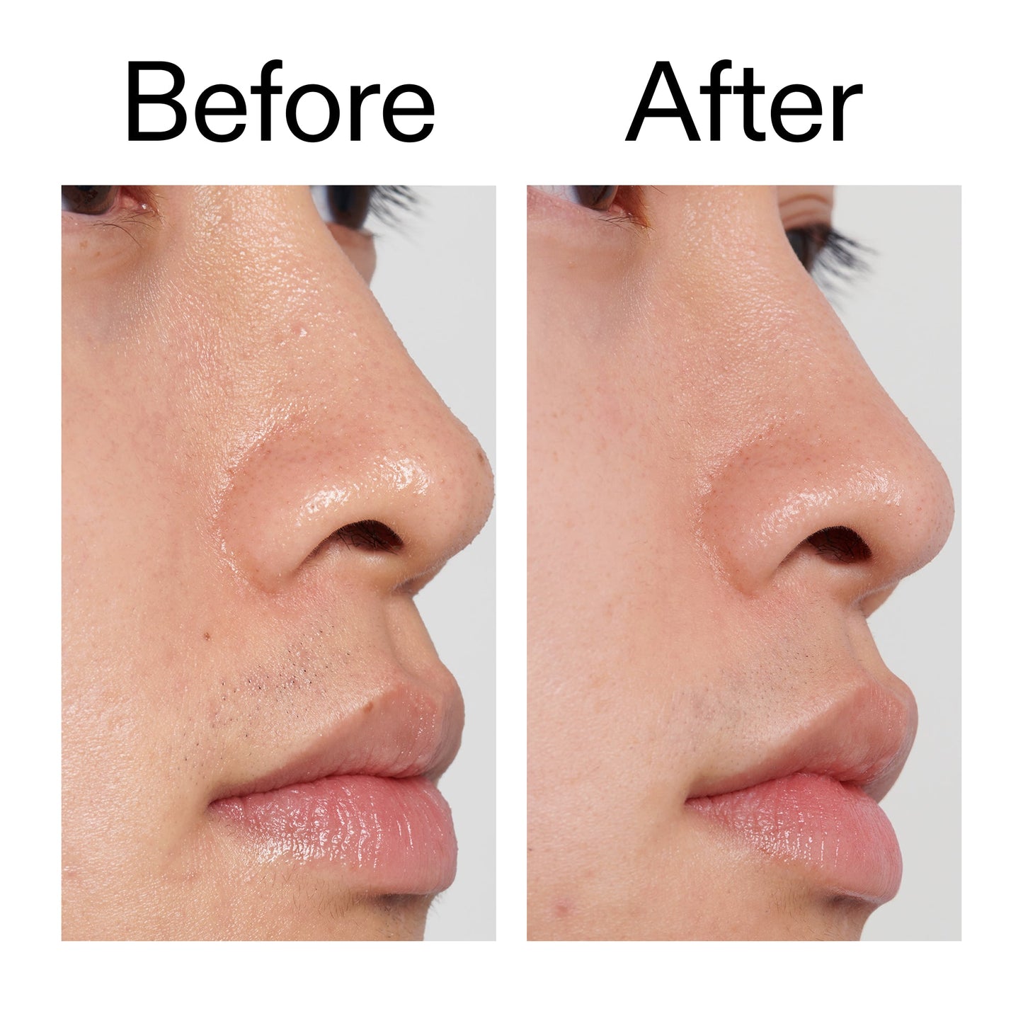 pha-toner-v3 PHA_Toner_Before_After_2000x2000_e3c10172-0150-4342-8b95-57417eaff50d.jpg