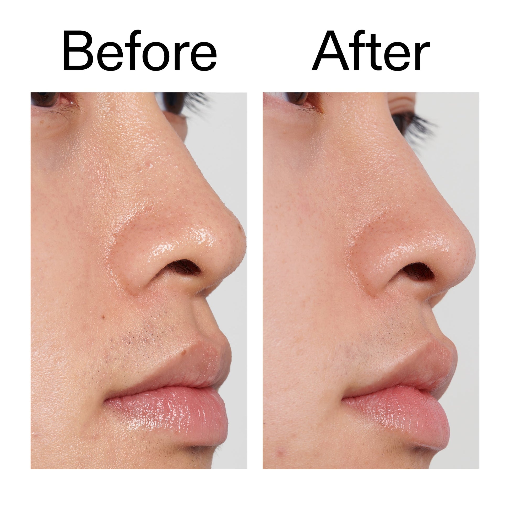 pha-toner-v3 PHA_Toner_Before_After_2000x2000_e3c10172-0150-4342-8b95-57417eaff50d.jpg
