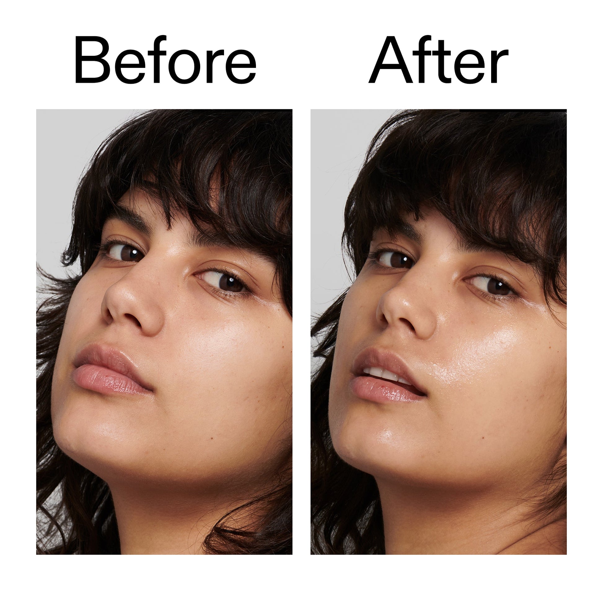 polyglutamic-acid-serum-i0 Polyglutamic_Acid_Serum_Before_After_2000x2000_dc0e1f71-d72b-4358-9c3a-ae43ead715d6.jpg