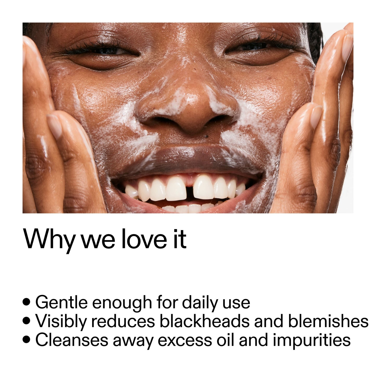 salicylic-acid-cleanser-150ml-a2 Salicylic_Acid_Cleanser_-_300mlWhy_we_love_it_2000x2000_87dc92a9-2559-4309-98cd-4e570f1be735.jpg