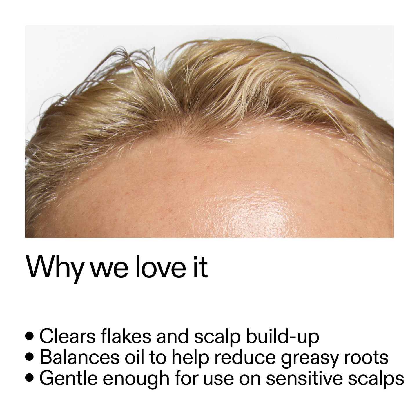 salicylic-acid-exfoliating-scalp-treatment-o6 Salicylic_Acid_Exfoliating_Scalp_Treatment_Why_we_love_it_2000x2000_44b6bd6d-9ec4-4b23-9dc4-bc3fd6f28e14.jpg
