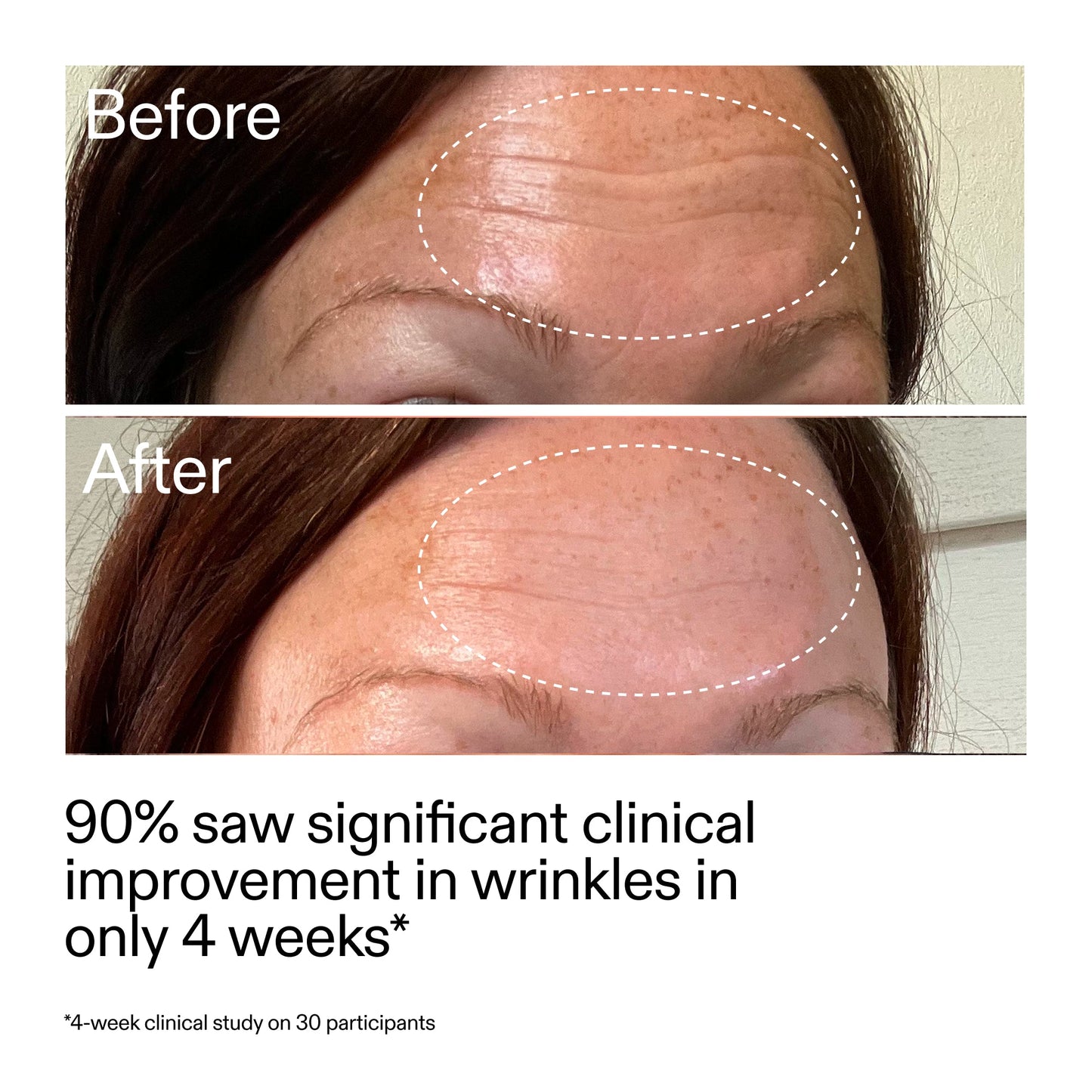 starter-retinol-serum-duo-l6 StarterRetinol_BeforeAfter_Claim1_2000x2000_03b4d6e5-a357-43b9-a855-aba5e35c57f3.jpg