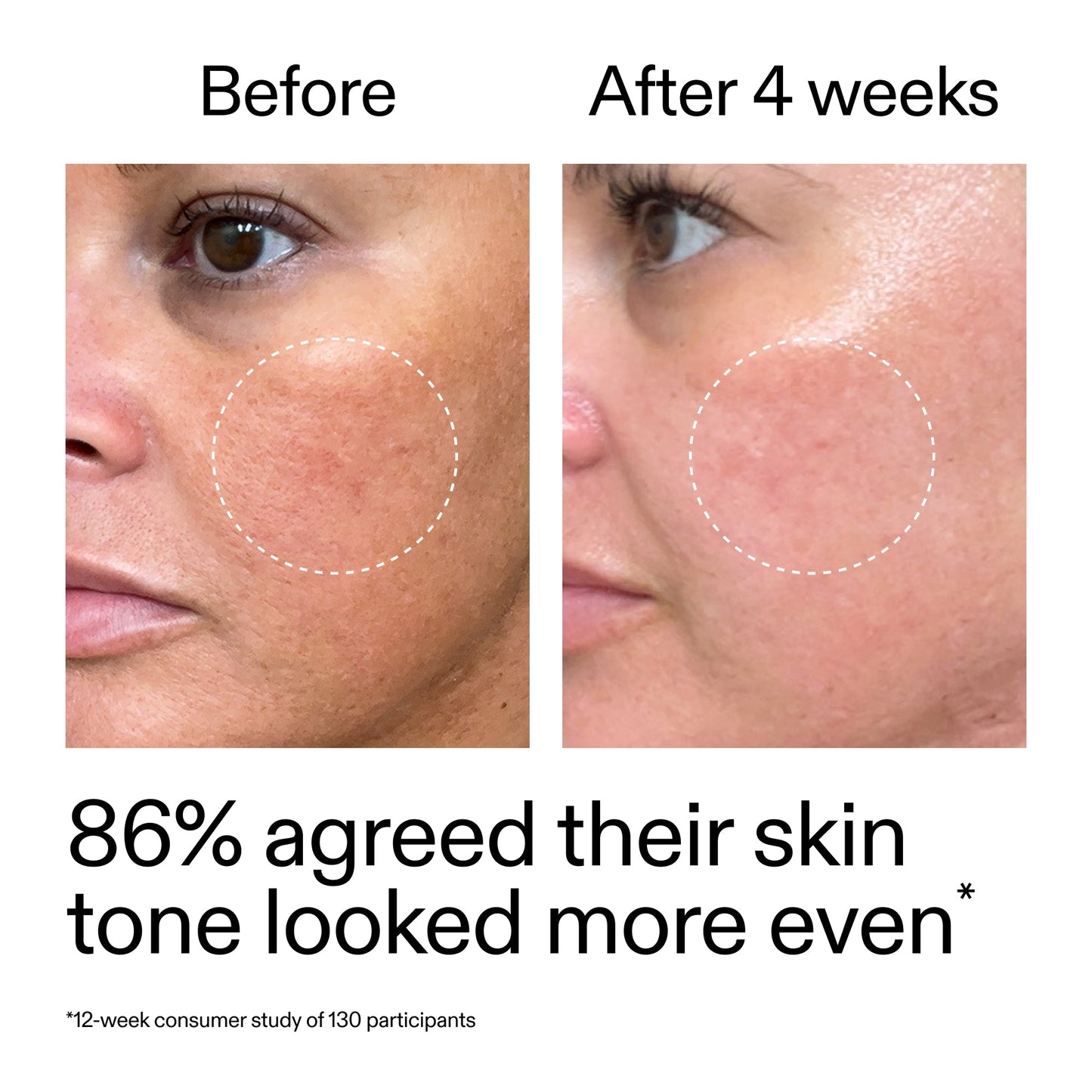 starter-retinol-serum-t6 StarterRetinol_BeforeAfter_Claim2_2000x2000_f5c9ecc0-8d76-429d-bef5-c3a61bcf5c09.jpg