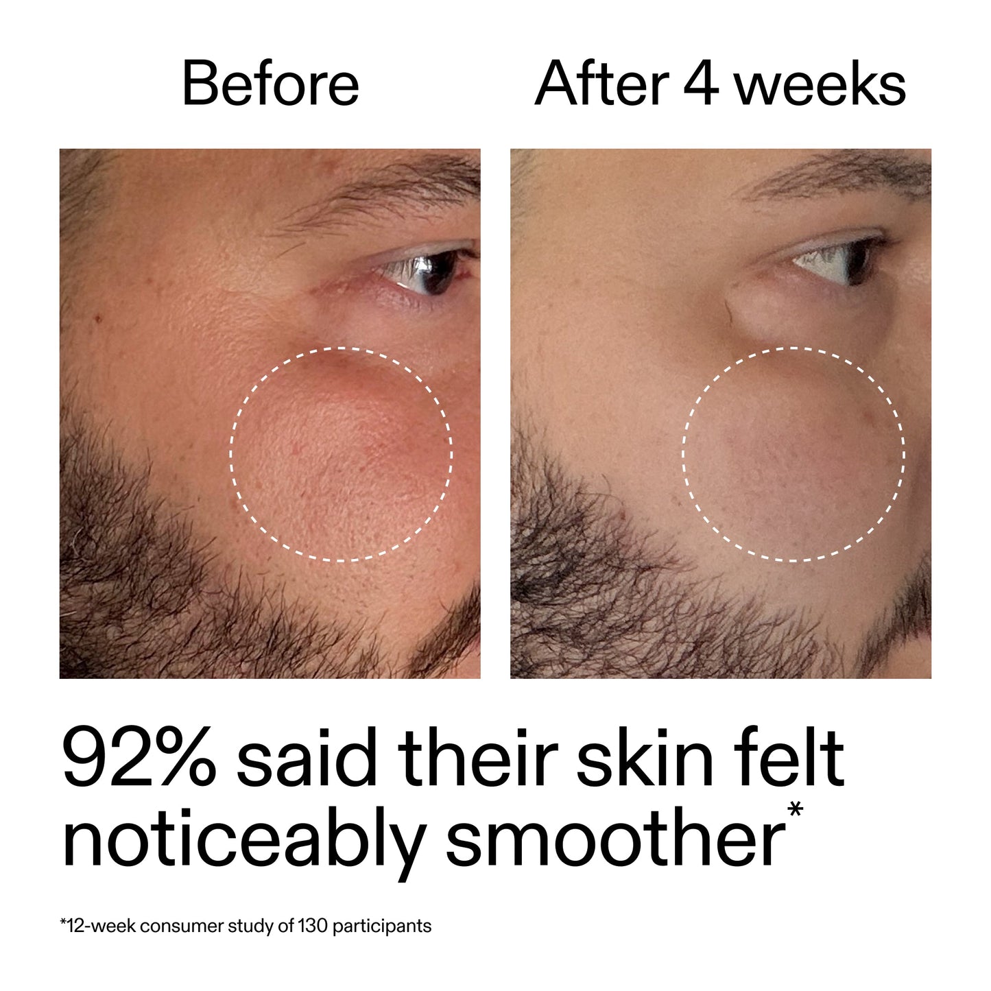 starter-retinol-serum-duo-l6 StarterRetinol_BeforeAfter_Claim3_2000x2000_458243a8-bbb0-4e5d-a274-29c7766d339b.jpg