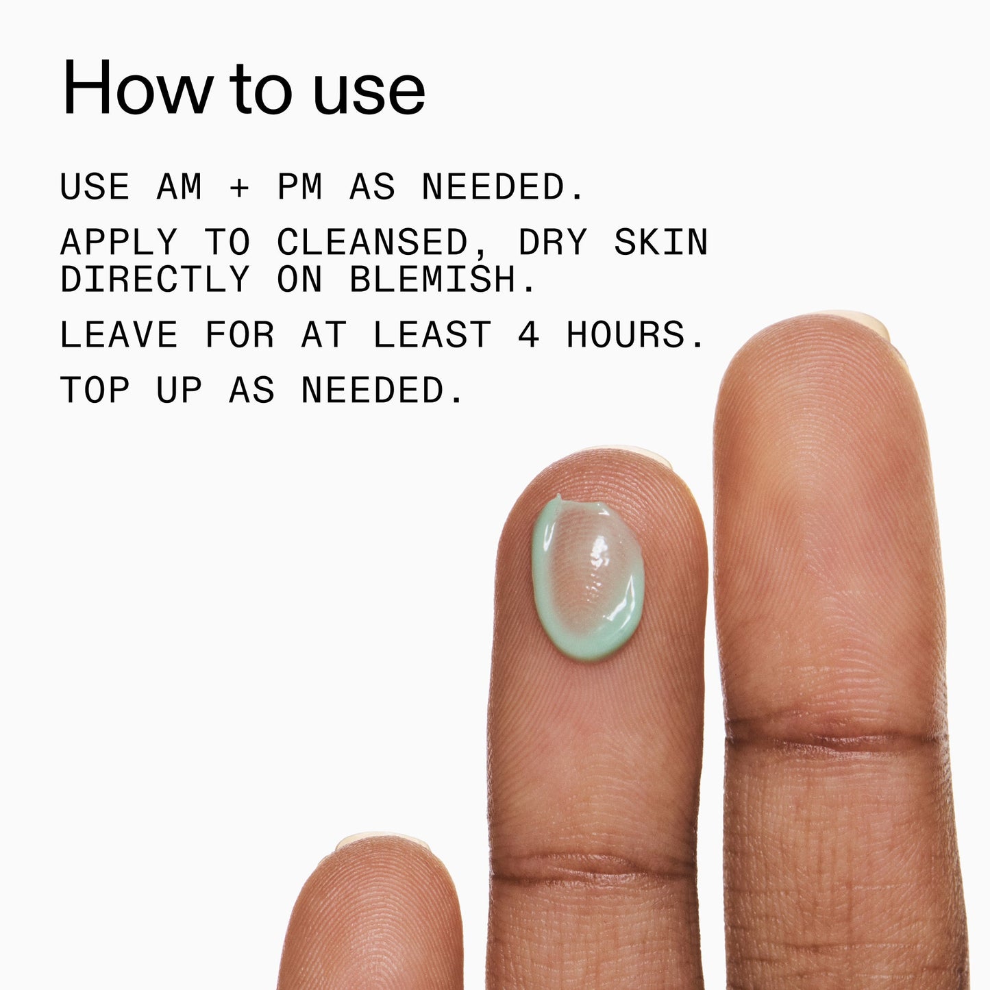 succinic-acid-acne-treatment-s3 Succinic_Acid_Treatment_How_to_Use_2000x2000_d57137d5-d7f1-427c-9a46-5fc00c19c542.jpg