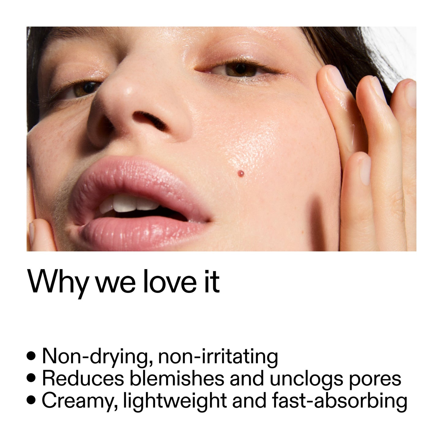 succinic-acid-acne-treatment-s3 Succinic_Acid_Treatment_Why_we_love_it_2000x2000_e90dd42a-cfe9-48b5-a2c7-d5eda787a6a8.jpg