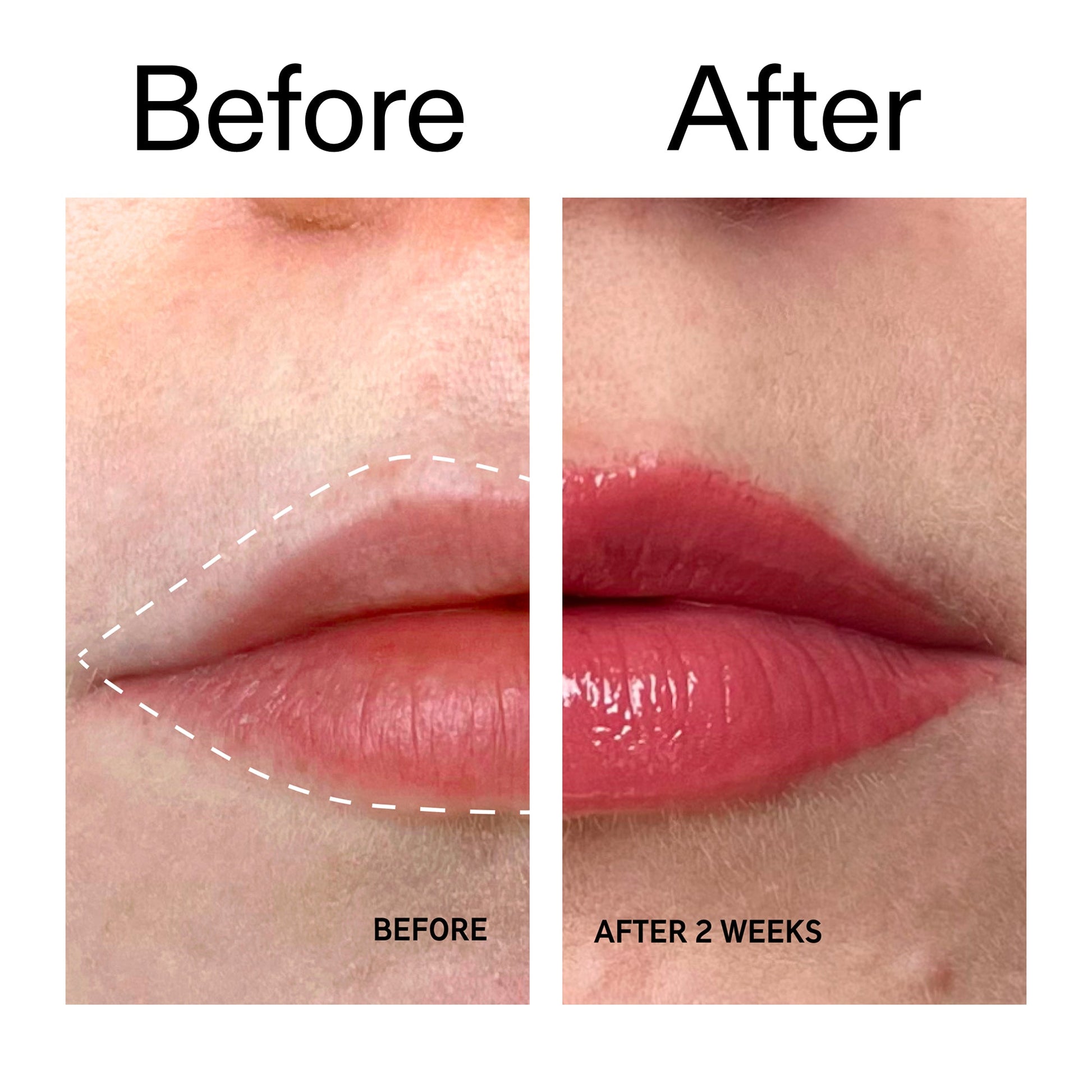 tripeptide-plumping-berry-lip-balm-v9 Tripeptide_Plumping_Lip_Balm_-_Berry_Before_After_2000x2000_9474bbd8-43ca-4b0e-b0e7-dfab70b91927.jpg