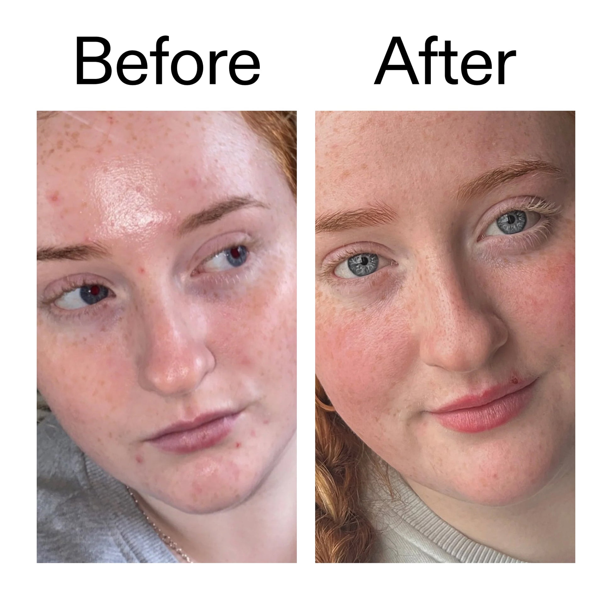 vitamin-b-c-and-e-moisturizer-b0 Vitamin_B_C_and_E_Moisturizer_Before_After_2000x2000_b0781a76-5ad2-4be9-95b8-ef92b356833c.jpg